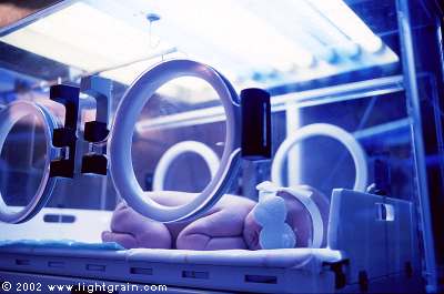 phototherapy on a newborn infant in humicrib