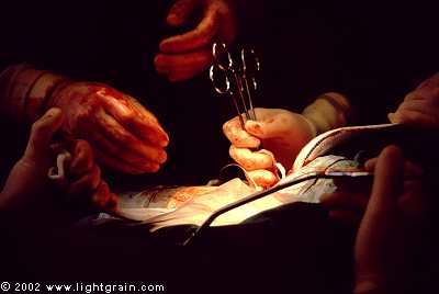 surgeons hands